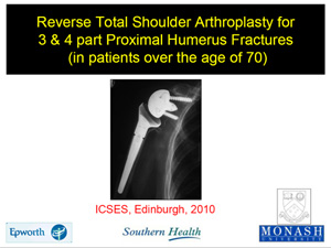 Prof Minoo Patel - Shoulder & Elbow Surgeon